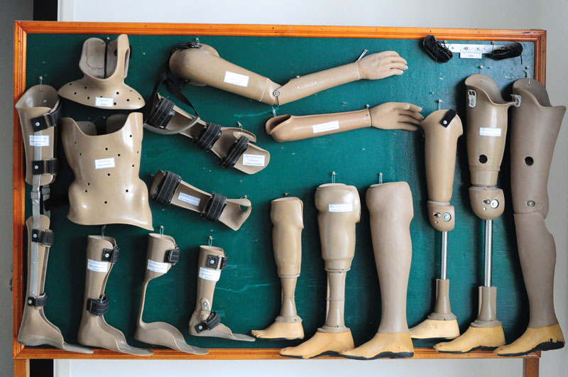 Prosthetics hang on the wall of the Cambodian School of Prosthetics and Orthotics in Phnom Penh. (Simon Henderson/The Cambodia Daily)
