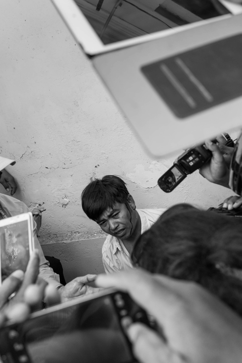 Pheng Leng, 46, after being beaten over the head by Daun Penh district security guards on Monday. Mr. Leng joined dozens of supporters of independent radio station owner Mam Sonando in a protest calling for a TV station and stronger radio frequency. (John Vink)