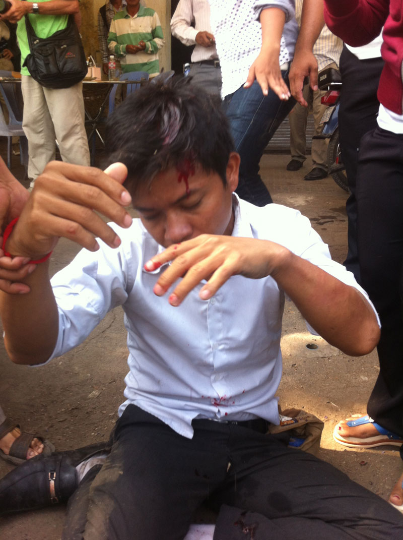 Security Guards Assault CNRP Supporters at Freedom Park 1 A CNRP supporter sits on the ground after being attacked by Daun Penh district security guards Monday morning. (Kevin Doyle)