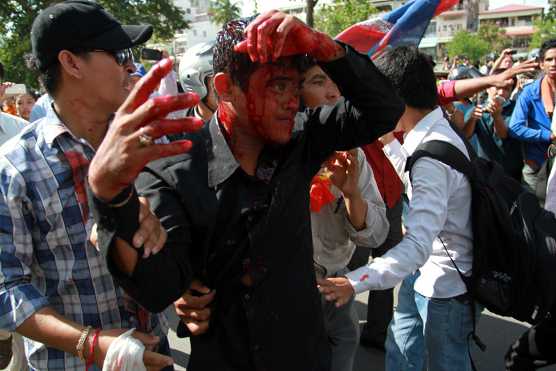 A security guard is bloodied following a clash with opposition CNRP protesters Tuesday near Freedom Park. (Siv Channa/The Cambodia Daily)