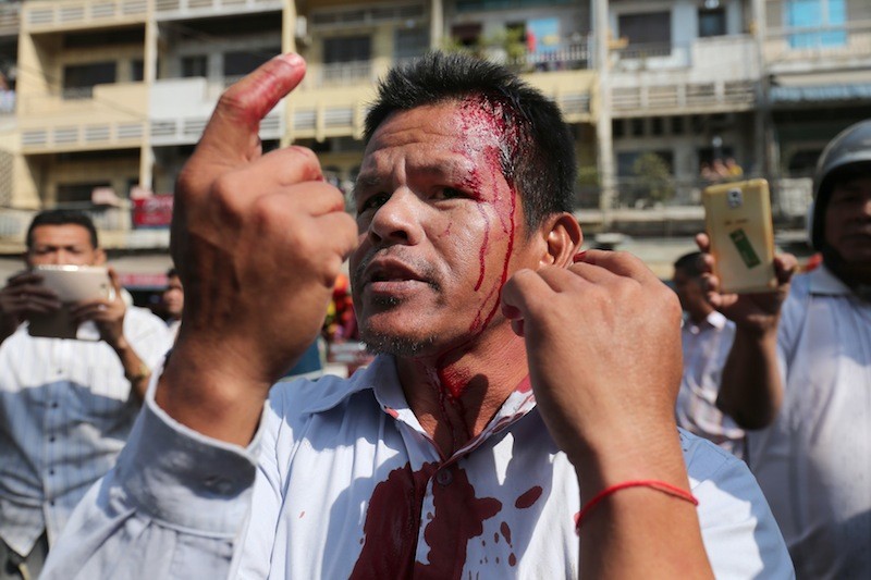 Thet Vuthy, a fired Capitol Tours bus driver, points at a head wound he sustained after being attacked by tuk-tuk drivers while protesting outside the company’s headquarters in Phnom Penh on Saturday. (Satoshi Takahashi) 