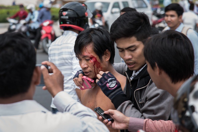 Suot Chet is surrounded by fellow unionists yesterday after being punched by a government security guard outside the National Assembly in Phnom Penh. (Siv Channa/The Cambodia Daily) 