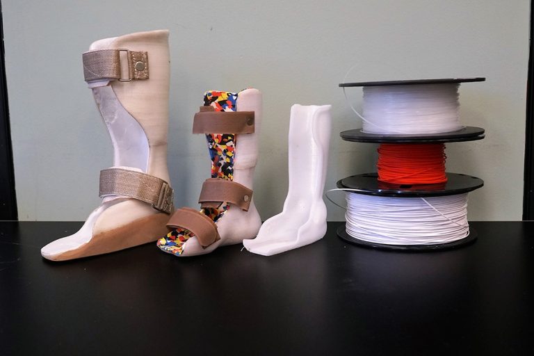 How 3D printing has sped up prosthetic development for people around the world