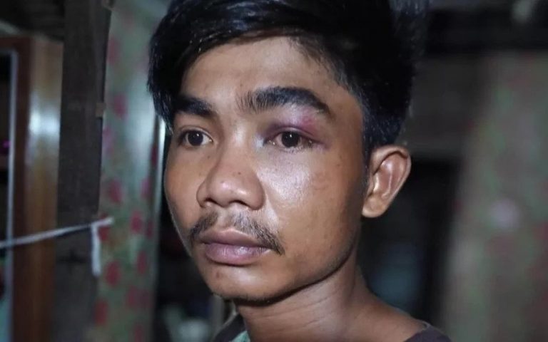 Victim Recounts Beating, Electric Shock at Hands of Prey Veng Officers